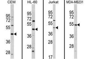 Western blot analysis of PTAR1 Antibody (Center) from left to right in CEM, HL-60, Jurkat, MDA-MB231 cell line lysates (35ug/lane). (PTAR1 抗体  (Middle Region))