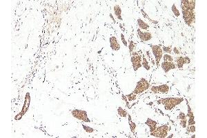 Immunohistochemistry (IHC) image for anti-Wingless-Type MMTV Integration Site Family, Member 3A (WNT3A) (N-Term) antibody (Biotin) (ABIN2477145) (WNT3A 抗体  (N-Term) (Biotin))