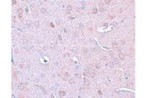 Immunohistochemistry (IHC) image for anti-Doublecortin-Like Kinase 1 (DCLK1) (N-Term) antibody (ABIN1031345) (DCLK1 抗体  (N-Term))