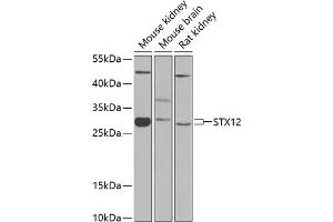 Western blot analysis of extracts of various cell lines, using STX12 antibody (ABIN6128798, ABIN6148655, ABIN6148656 and ABIN6224224) at 1:1000 dilution. (Syntaxin 12 抗体  (AA 1-250))