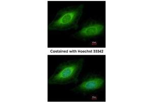ICC/IF Image Immunofluorescence analysis of methanol-fixed HeLa, using TSSC1, antibody at 1:200 dilution. (TSSC1 抗体  (Center))