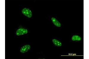 Immunofluorescence of monoclonal antibody to ZFHX3 on HeLa cell. (ZFHX3 抗体  (AA 2811-2910))