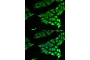 Immunofluorescence analysis of U2OS cells using PSAT1 antibody. (PSAT1 抗体  (AA 1-370))