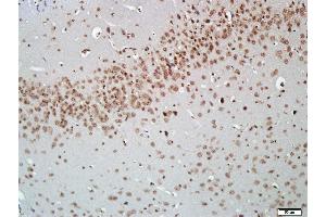 Paraformaldehyde-fixed, paraffin embedded Mouse brain, Antigen retrieval by boiling in sodium citrate buffer (pH6. (AKT2 抗体  (AA 101-200))
