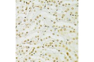Immunohistochemistry of paraffin-embedded mouse kidney using ADAR antibody.