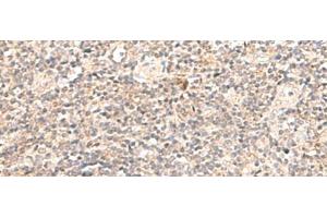 Immunohistochemistry of paraffin-embedded Human tonsil tissue using TRAPPC1 Polyclonal Antibody at dilution of 1:50(x200) (TRAPPC1 抗体)