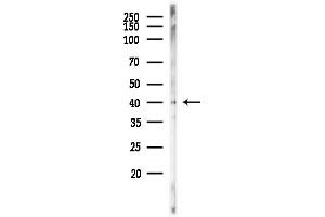 Western blot analysis of lysates from Mouse testis, using Phospho-Nucleophosmin (Thr95) Antibody at 1/1000 dilution.
