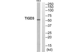Western blot analysis of extracts from COLO205 cells, using TIGD3 antibody. (TIGD3 抗体  (C-Term))