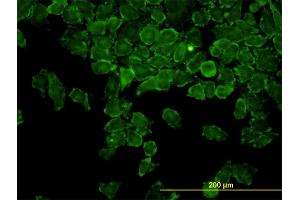 Immunofluorescence of monoclonal antibody to CAP2 on HeLa cell. (CAP2 抗体  (AA 1-477))