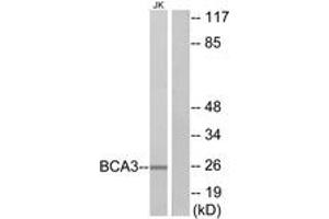 Western Blotting (WB) image for anti-A Kinase (PRKA) Interacting Protein 1 (AKIP1) (AA 111-160) antibody (ABIN2889769) (AKIP1 抗体  (AA 111-160))