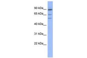 Image no. 1 for anti-Tripartite Motif Containing 50 (TRIM50) (AA 395-444) antibody (ABIN6742937) (TRIM50 抗体  (AA 395-444))