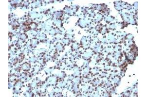 Formalin-fixed, paraffin-embedded rat pancreas stained with SUMO-1 antibody (SUMO1/1188) (SUMO1 抗体)