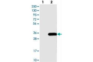 Western blot analysis of Lane 1: Negative control (vector only transfected HEK293T lysate), Lane 2: Over-expression Lysate (Co-expressed with a C-terminal myc-DDK tag (~3. (SLC25A10 抗体)