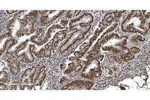 IHC analysis of Ku70 using anti-Ku70 antibody (ABIN7602790).