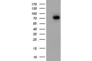 Western Blotting (WB) image for anti-SAM Domain and HD Domain 1 (SAMHD1) antibody (ABIN1500800) (SAMHD1 抗体)