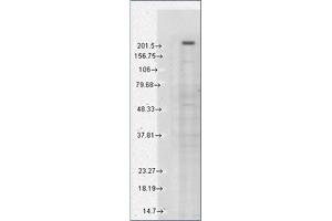 Western Blotting (WB) image for anti-Transient Receptor Potential Cation Channel, Subfamily M, Member 7 (TRPM7) (AA 1817-1863), (C-Term) antibody (ABIN452417) (TRPM7 抗体  (C-Term))