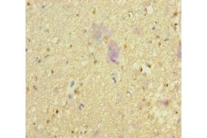 Immunohistochemistry of paraffin-embedded human brain tissue using ABIN7161659 at dilution of 1:100