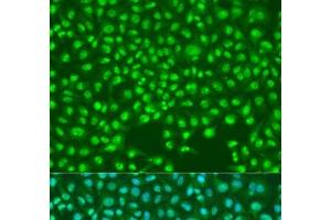 Immunofluorescence analysis of U2OS cells using SKP2 Polyclonal Antibody at dilution of 1:100. (SKP2 抗体)