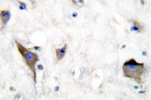 Image no. 1 for anti-PTK2B Protein tyrosine Kinase 2 beta (PTK2B) antibody (ABIN271797) (PTK2B 抗体)