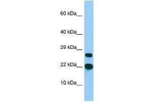 Host: Rabbit Target Name: BTF3L4 Sample Type: MCF7 Whole Cell lysates Antibody Dilution: 1. (BTF3L4 抗体  (C-Term))