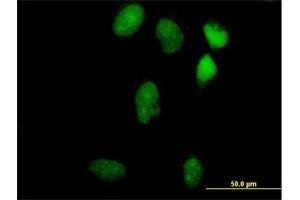 Immunofluorescence of purified MaxPab antibody to LIN9 on HeLa cell. (LIN9 抗体  (AA 1-558))
