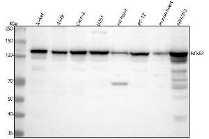 Western blot analysis of NF-κB p100/p52 using anti-NF-κB p100/p52 antibody (ABIN7605714).