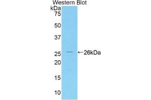 Western blot analysis of the recombinant protein. (IRAK3 抗体  (AA 201-410))