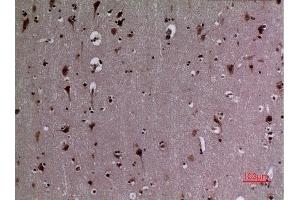 Immunohistochemistry (IHC) image for anti-Heat Shock Protein 90 (HSP90) (acLys284), (acLys292) antibody (ABIN3181886)