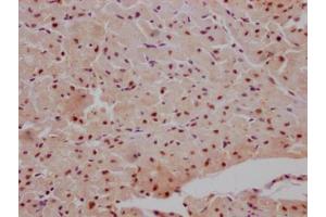IHC image of ABIN7127610 diluted at 1:100 and staining in paraffin-embedded human heart tissue performed on a Leica BondTM system. (Recombinant MAPKAP Kinase 2 抗体)