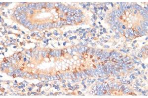 Immunohistochemistry of paraffin-embedded Human appendix using WNK3 Polyclonal Antibody at dilution of 1:100 (40x lens). (WNK3 抗体)