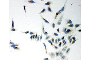 ICC testing of NOX5 antibody and HeLa cells (NOX5 抗体  (C-Term))