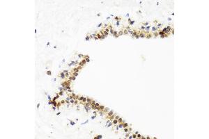 Immunohistochemistry of paraffin-embedded human breast using TOP1 antibody. (Topoisomerase I 抗体)