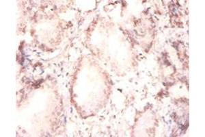 Immunohistochemistry of paraffin-embedded human prostate tissue using ABIN7152800 at dilution of 1:100