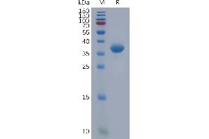 SDS-PAGE (SDS) image for Chemokine (C-X-C Motif) Ligand 1 (Melanoma Growth Stimulating Activity, Alpha) (CXCL1) protein (Fc Tag) (ABIN6964250)