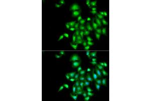 Immunofluorescence analysis of  cells using IL20 antibody (ABIN6128133, ABIN6142353, ABIN6142354 and ABIN6222322). (IL-20 抗体  (AA 25-176))