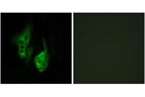 Immunofluorescence analysis of HeLa cells, using OPN5 Antibody. (OPN5 抗体  (AA 251-300))
