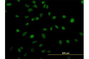 Immunofluorescence of monoclonal antibody to ZNF207 on HeLa cell. (ZNF207 抗体  (AA 1-110))