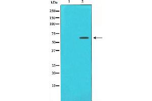 Western blot analysis of Estrogen Receptor-alpha expression in 293 whole cell lysates,The lane on the left is treated with the antigen-specific peptide. (Estrogen Receptor alpha 抗体  (C-Term))