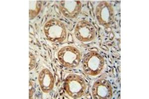 Formalin fixed, paraffin embedded Human kidney tissue stained with LNPEP Antibody (N-Term) followed by peroxidase conjugation of the secondary antibody and DAB staining. (LNPEP 抗体  (N-Term))