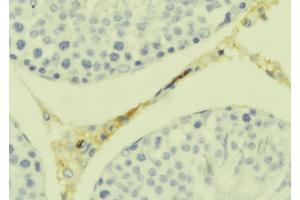 ABIN6277686 at 1/100 staining Mouse testis tissue by IHC-P. (TWEAK 抗体  (N-Term))