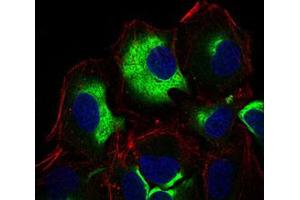 Immunofluorescent staining of HeLa cells using IL3RA monoclonal antibody, clone 10B8E7 . (IL3RA 抗体)