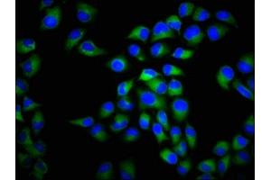 Immunofluorescence staining of Hela cells with ABIN7175586 at 1:266, counter-stained with DAPI. (CACNA1C 抗体  (AA 1755-1971))