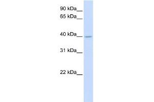 SRD5A3 antibody used at 1 ug/ml to detect target protein. (SRD5A3 抗体  (N-Term))