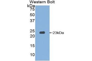 Western blot analysis of the recombinant protein. (SIT1 抗体  (AA 2-175))