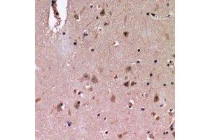 Immunohistochemical analysis of Cadherin 20 staining in human brain formalin fixed paraffin embedded tissue section. (Cadherin 20 抗体)