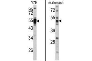 (LEFT) Western blot analysis of PDIA6 antibody (Center K159) in Y79 cell line lysates (35ug/lane). (PDIA6 抗体  (Middle Region))