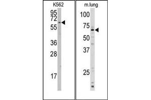 Image no. 1 for anti-Cytochrome P450, Family 1, Subfamily A, Polypeptide 1 (CYP1A1) (AA 384-414), (C-Term) antibody (ABIN360413) (CYP1A1 抗体  (C-Term))