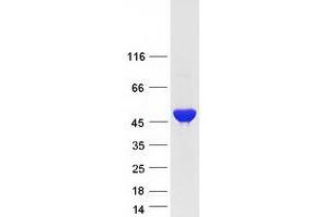 Western Blotting (WB) image for Argininosuccinate Lyase (ASL) (Transcript Variant 1) protein (Myc-DYKDDDDK Tag) (ABIN2714867)