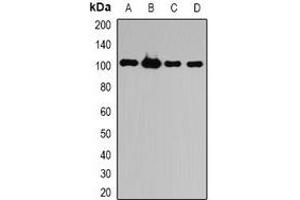 Western blot analysis of ATG9B expression in HepG2 (A), HL60 (B), mouse liver (C), rat brain (D) whole cell lysates. (ATG9B 抗体)