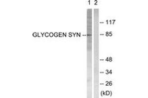 Western blot analysis of extracts from HeLa cells, treated with Serum 20% 30', using Glycogen Synthase (Ab-645) Antibody. (Glycogen Synthase 抗体  (AA 621-670))
